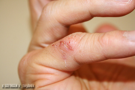 Finger Slice Finger Slice