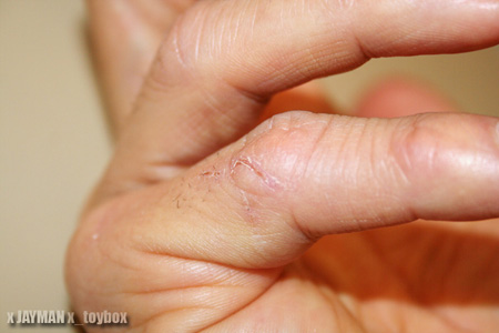 Finger Slice Finger Slice